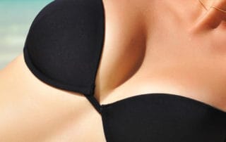 oberkoerper frau mit schwarzem bikini nach brust op
