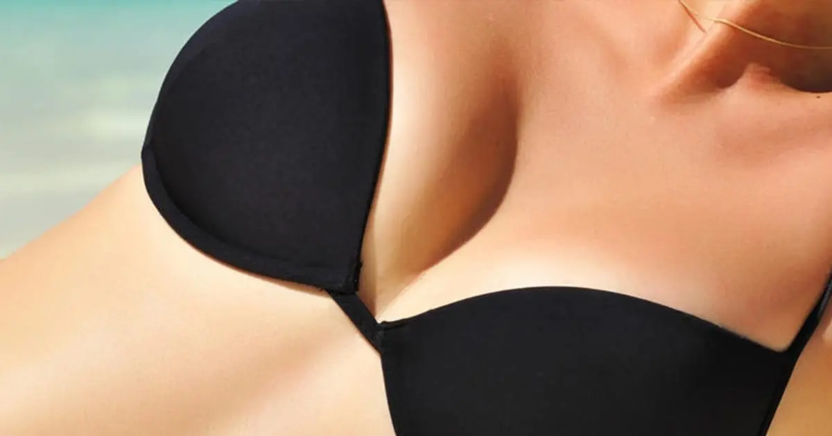 oberkoerper frau mit schwarzem bikini nach brust op