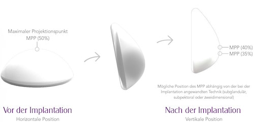 Dr. Bauer Motiva TrueTissue Technology