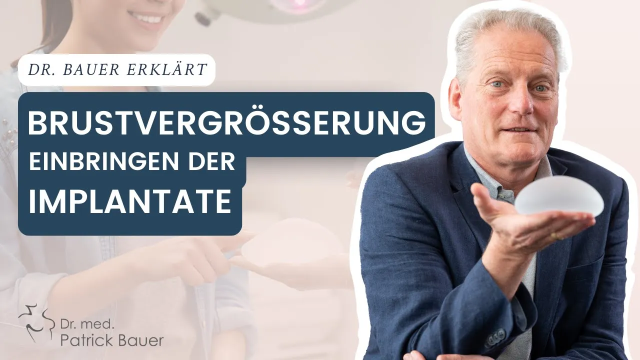 einbringen der implantate video