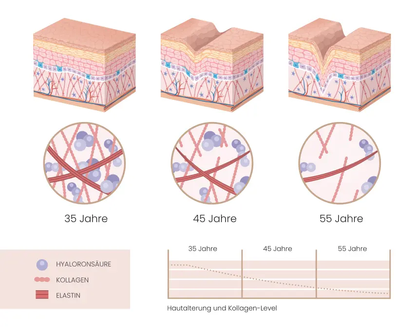 grafik hautalterung elastin kollagen dr bauer grafik hautalterung elastin kollagen dr bauer