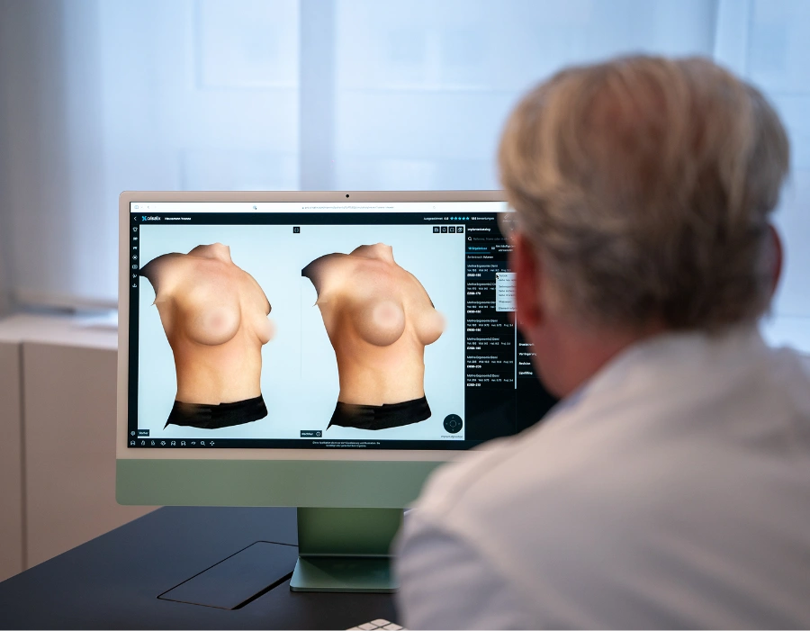 3d simulation brust crisalix muenchen dr bauer